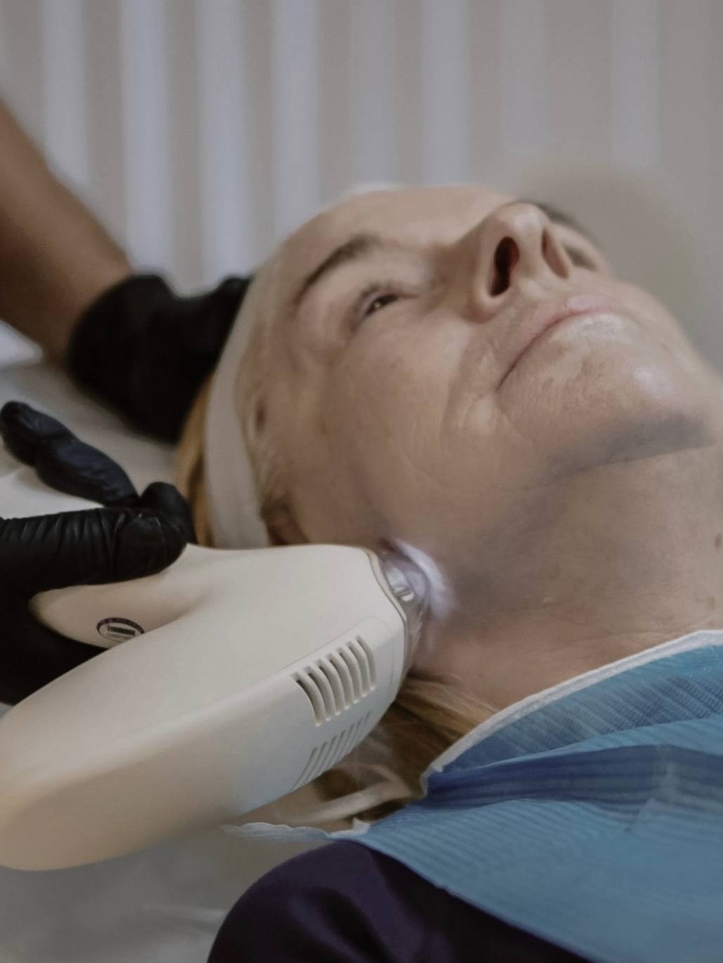 MaTixelle treatment being applied beneath the chin